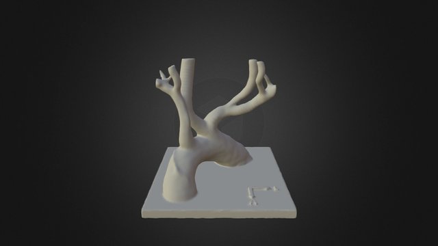AORT 3D Model