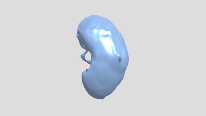 Segmentation_ Left Kidney 3D Model