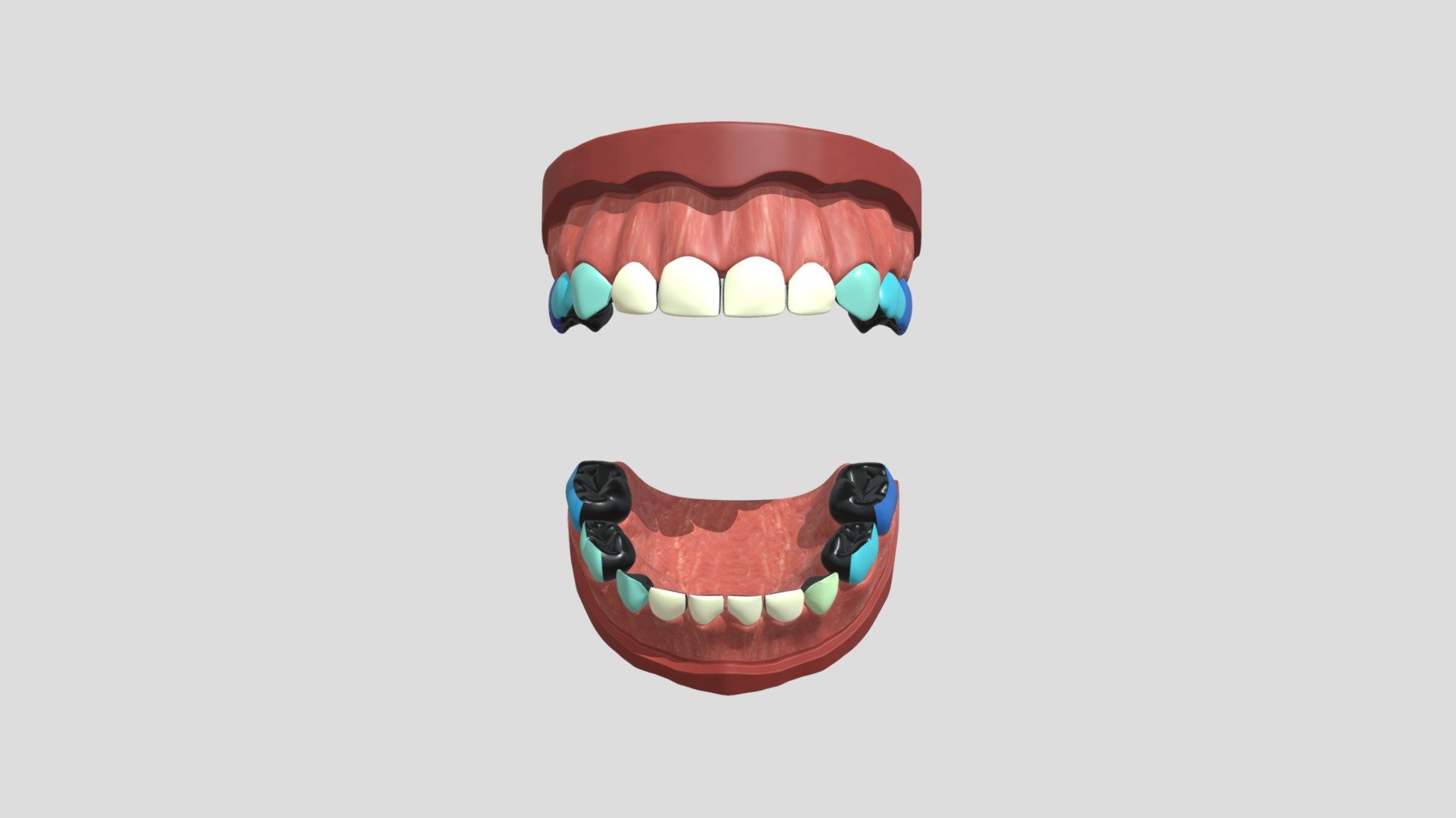 hypo_nzunrestored_2cm_2c