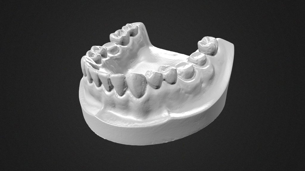 Dental Mold 3D Scan