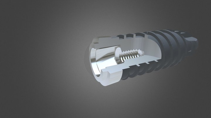 Thommen Medical Implant Abutment Connection 3D Model