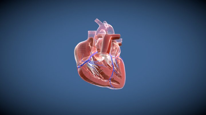 Heart Pump AVC Type II 3D Model