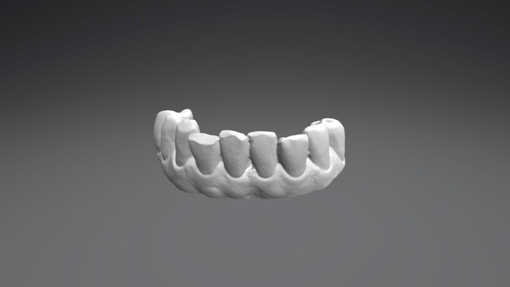 Manuela Lower Jaw