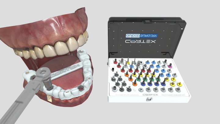 COR Kit Guided Surgery Cortex 3D Model