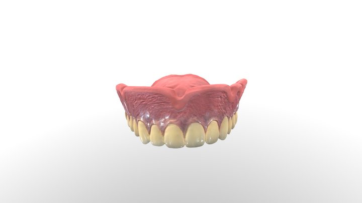 シリコン併用(総義歯) 3D Model