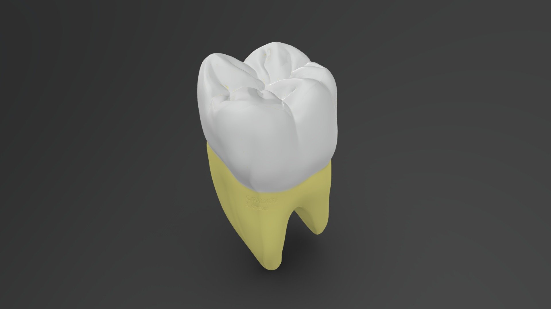 Mandibular Right First Molar Dental Anatomy