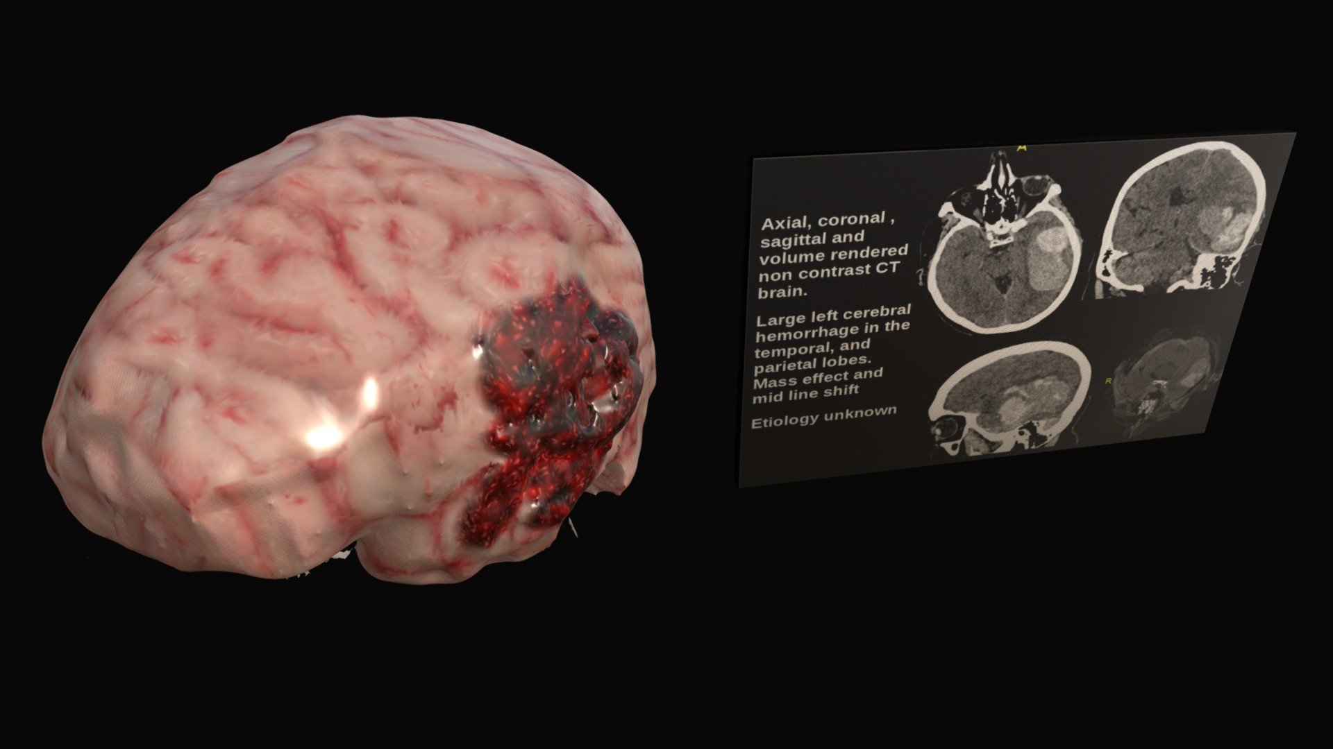 cerebrum dispersio music ridiculon