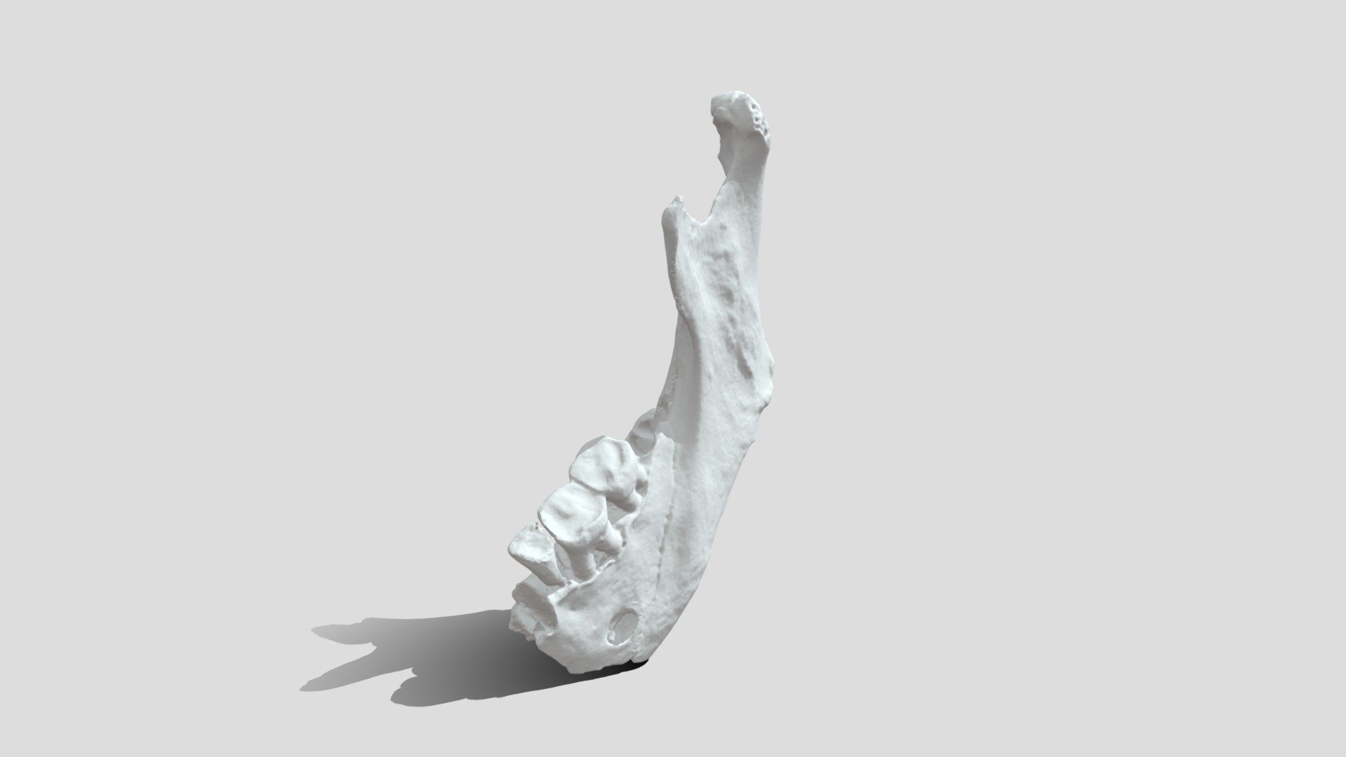 Mandible