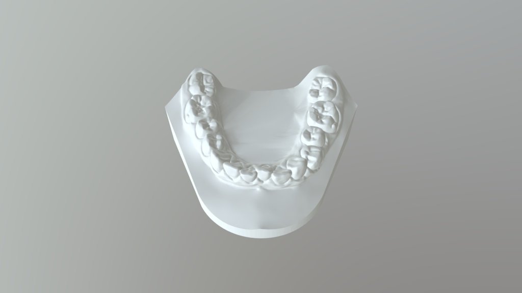 CASO B MODELO INFERIOR ORTODONCIA - 3D Model By Drandrescordova ...