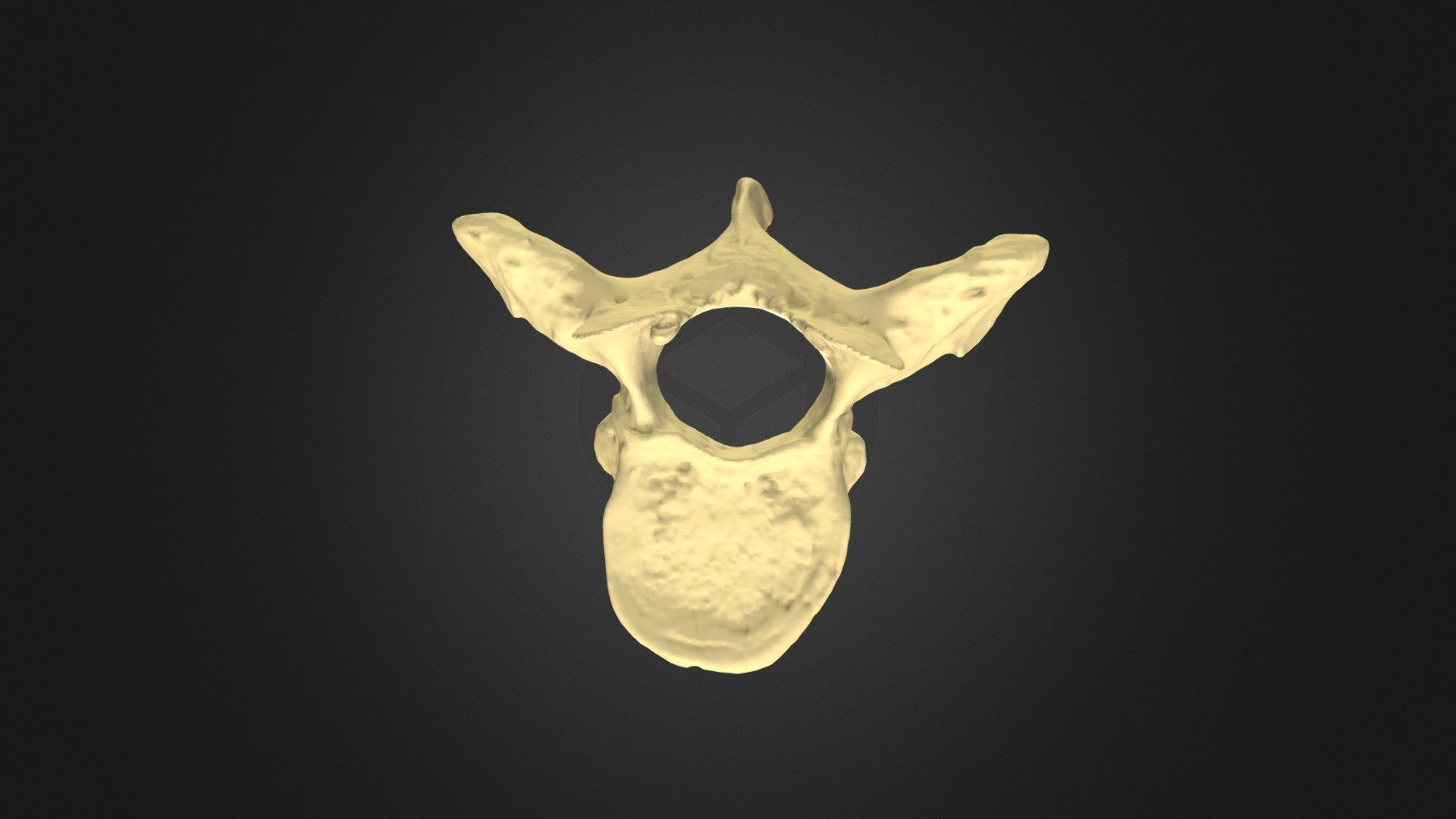 T5 Vertebra — Sketchfab embed 3D viewer