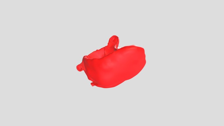 Post Norwood Heart 3D Model