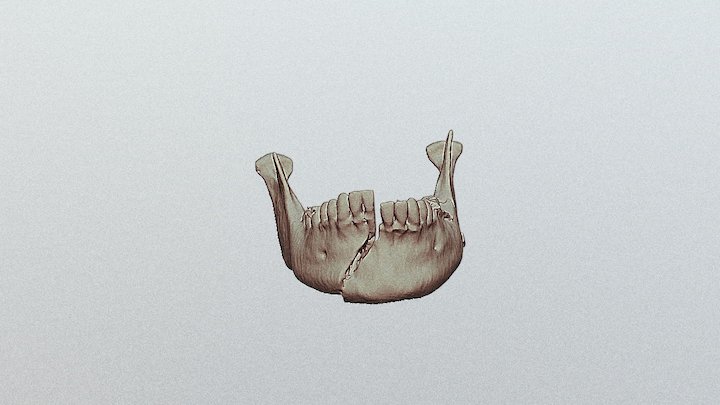 Mandible 2b 3D Model