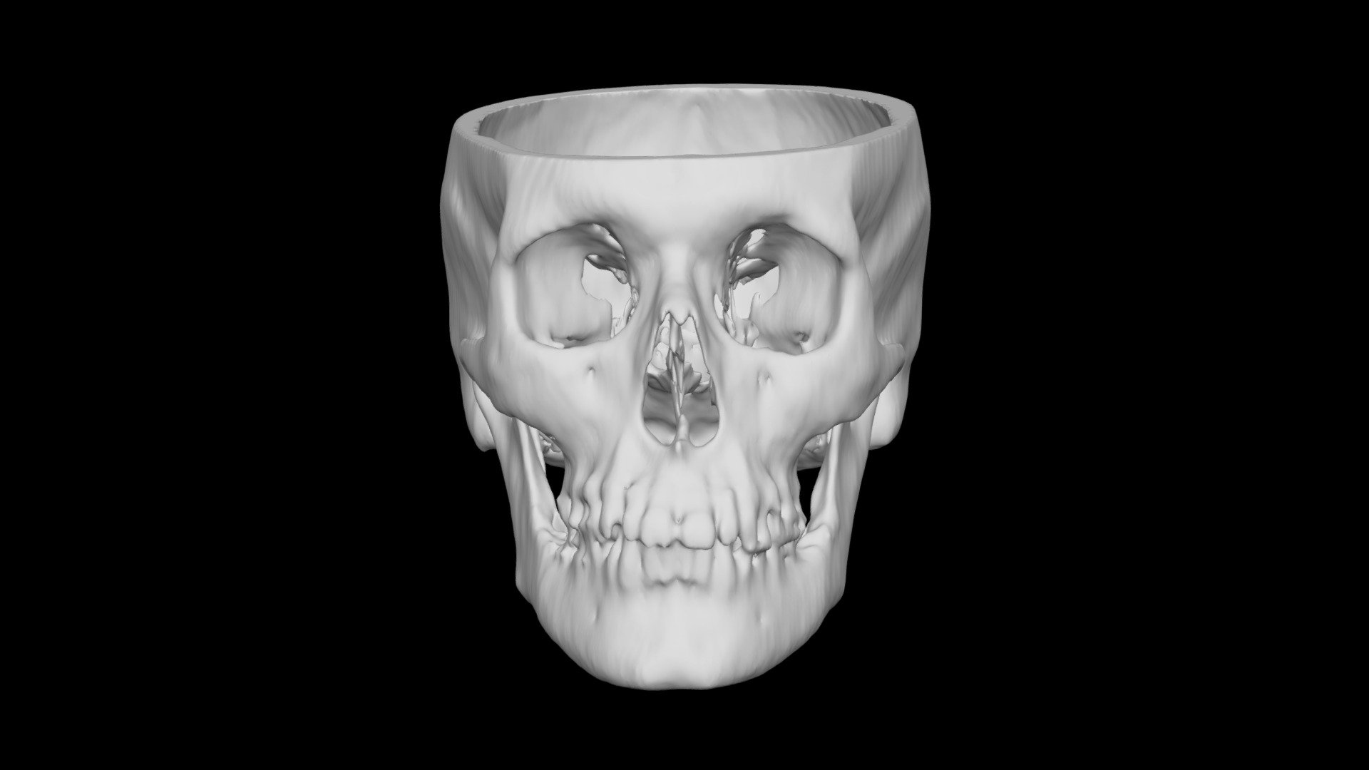 Skull Male 61yo