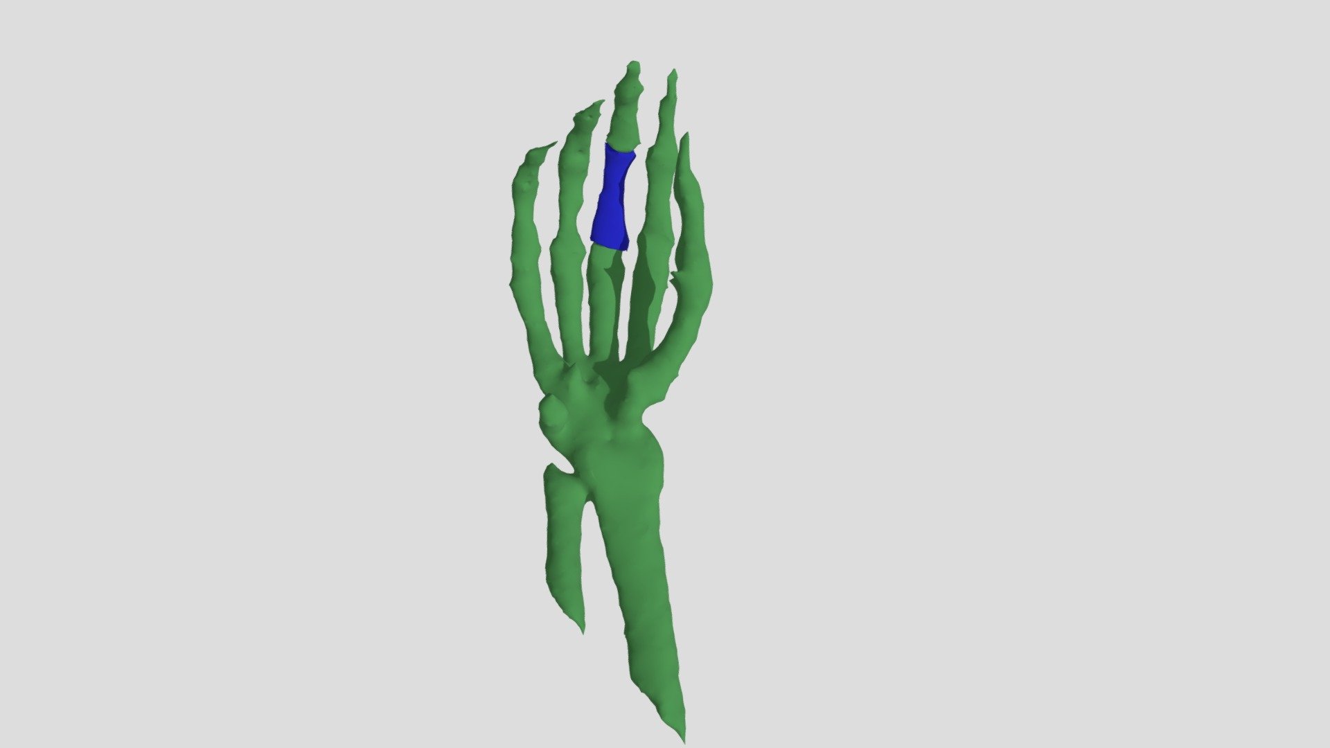 Right Third Proximal Phalange: Male 42