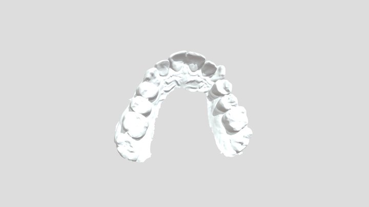 ткач UpperJawScan 3D Model