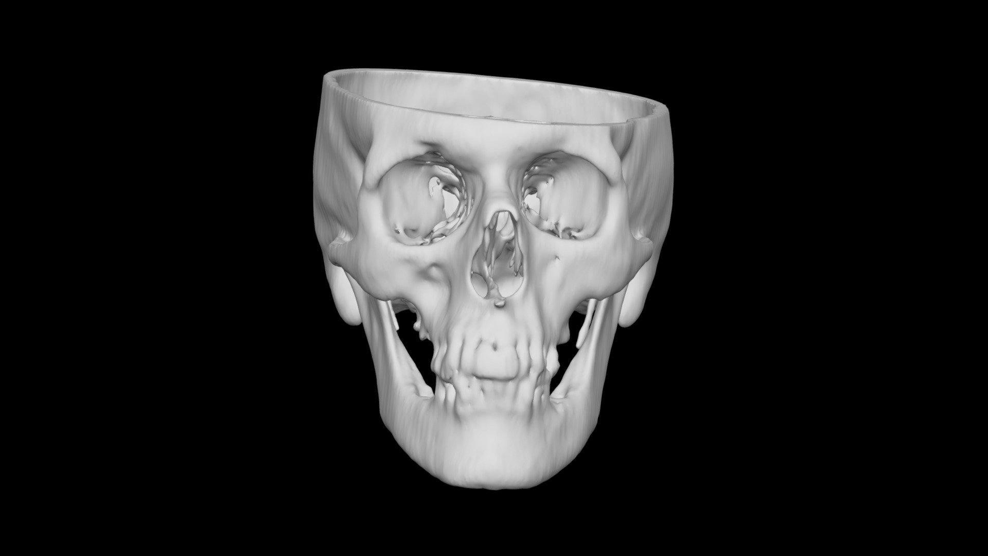 Skull Male 51yo