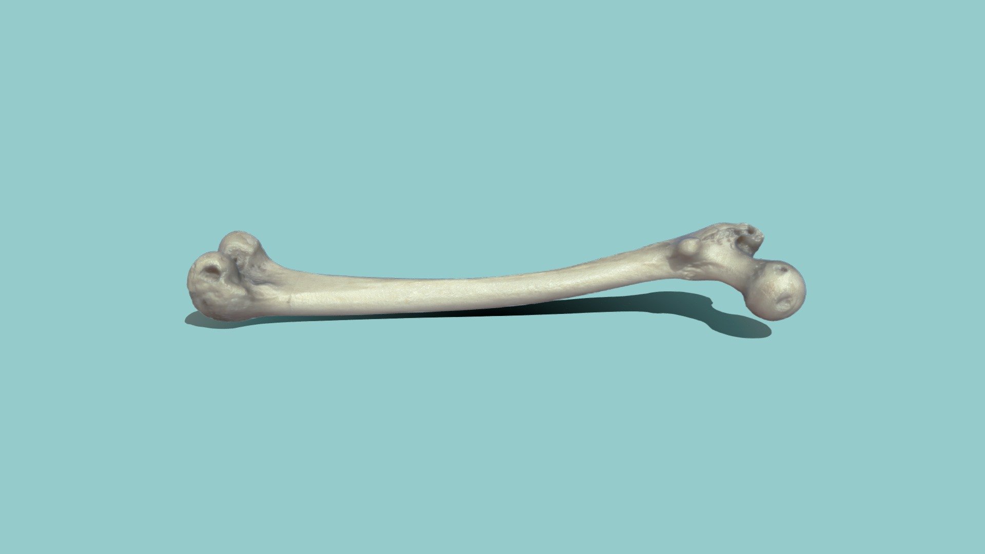 UD3 Femur-1