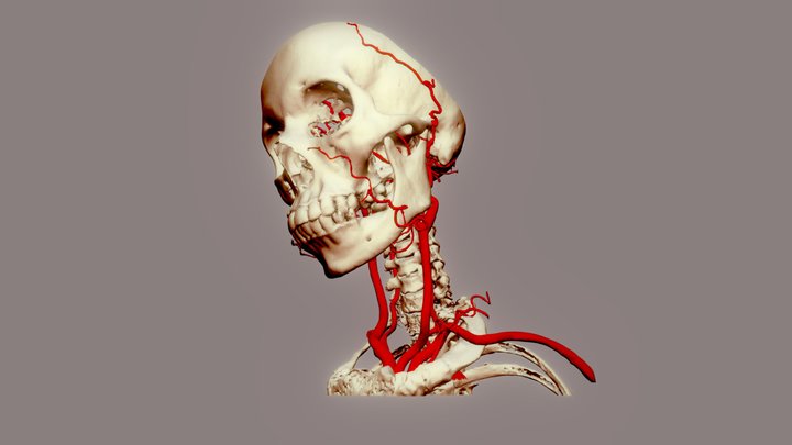 Arteries of head & neck 3D Model