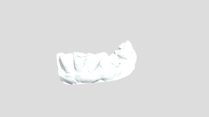 Dental bridge 3D Model