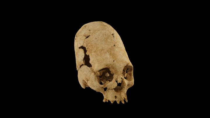 Artificialy deformed skull - Dully - 5th c. AD 3D Model