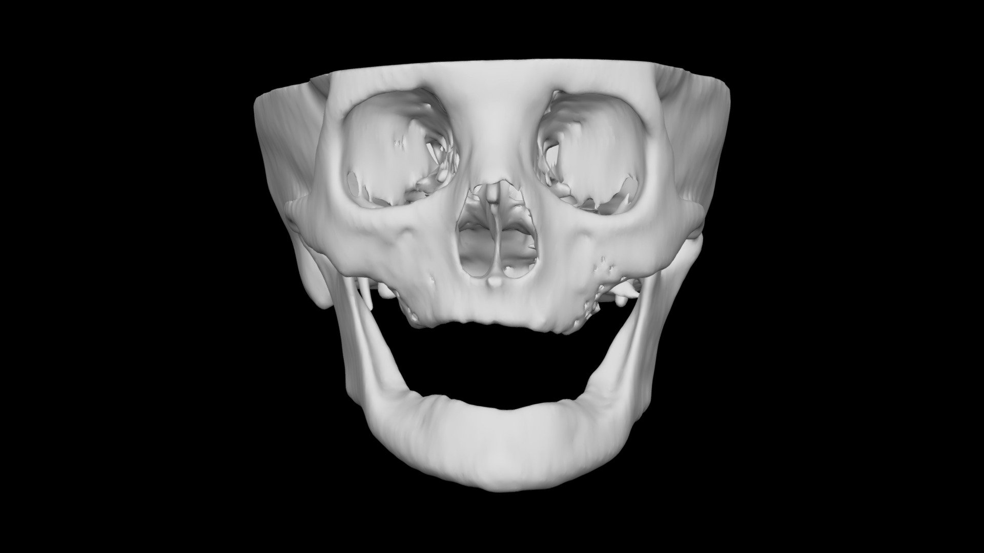 Skull Female 79yo