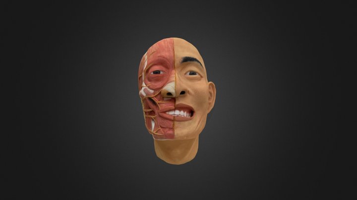 Facial ecorche: Bell's Palsy & COVID 19 vaccine 3D Model