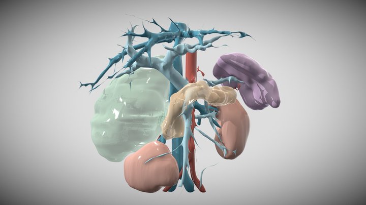 Giant AML of right adrenal gland 3D Model