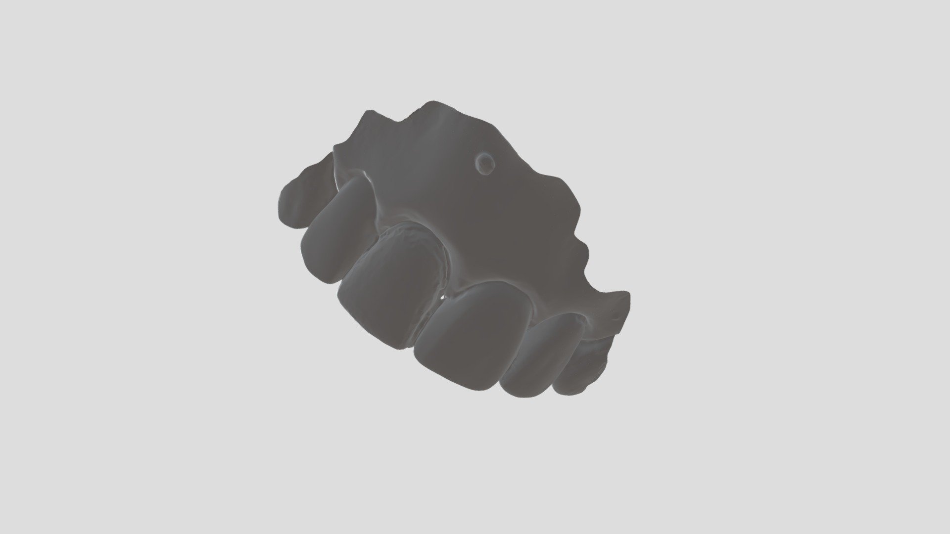Group 14 Tooth #8-2