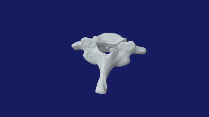 C7 - cervical vertebra – Free 3D Model STL