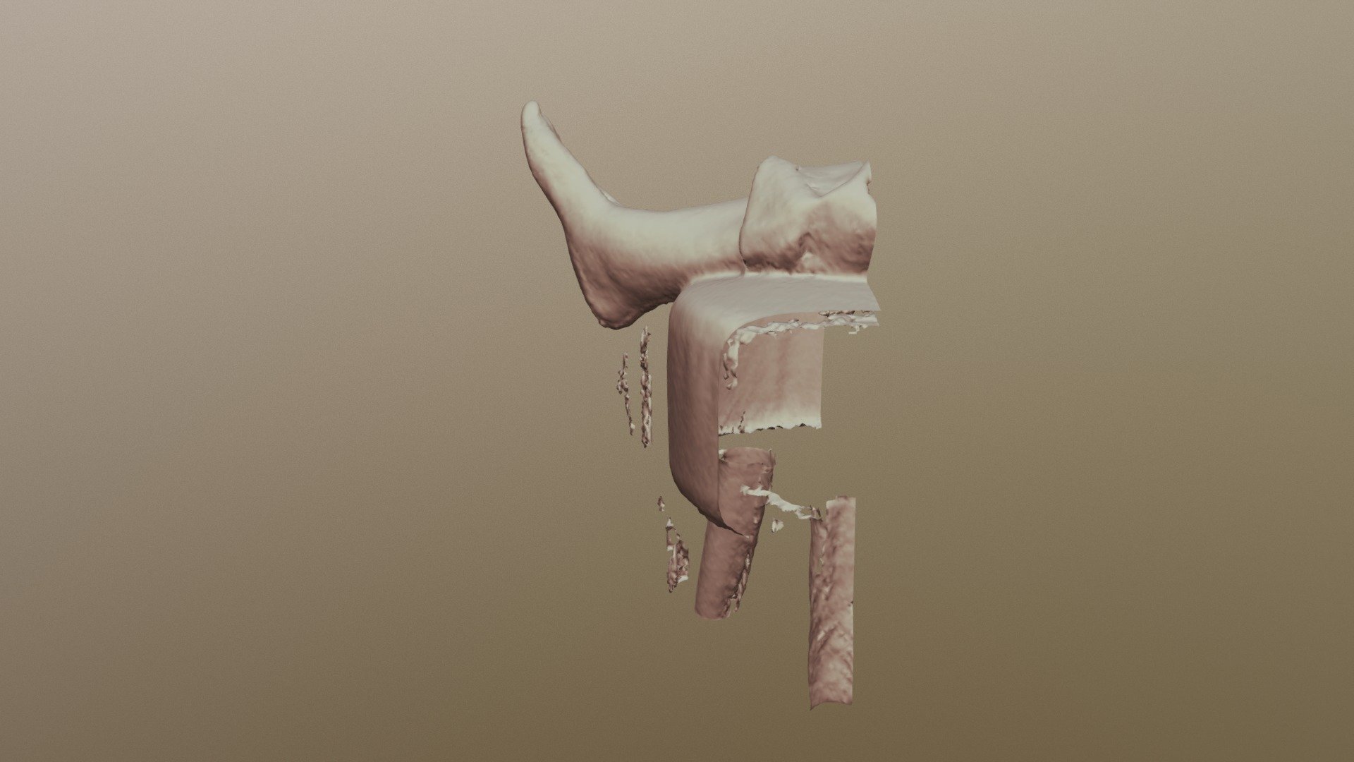 Model
