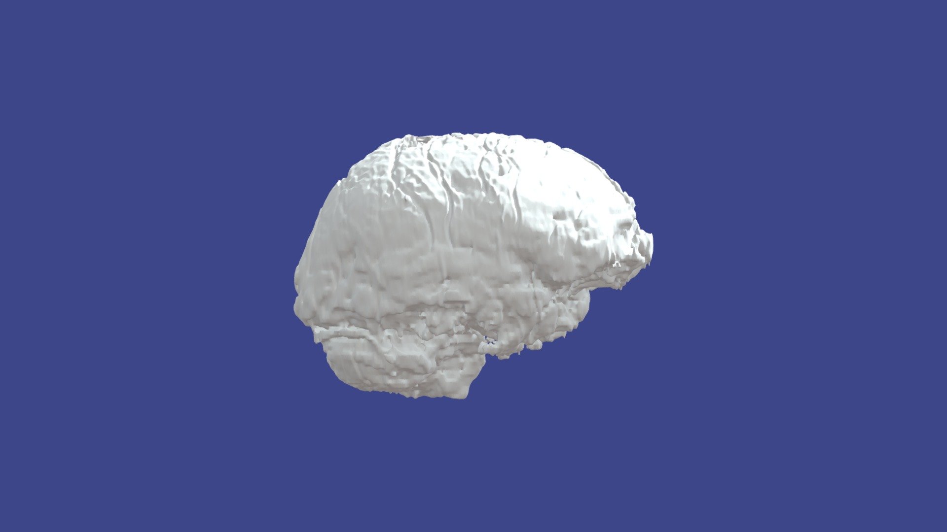 Brain of Felipe