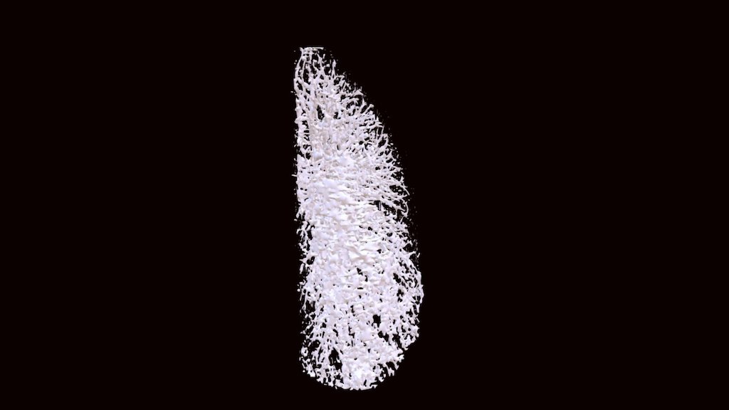 lung_resampled