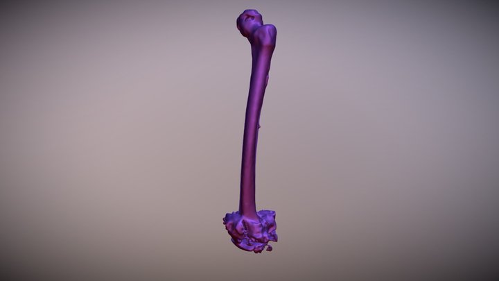 left femur 3D Model