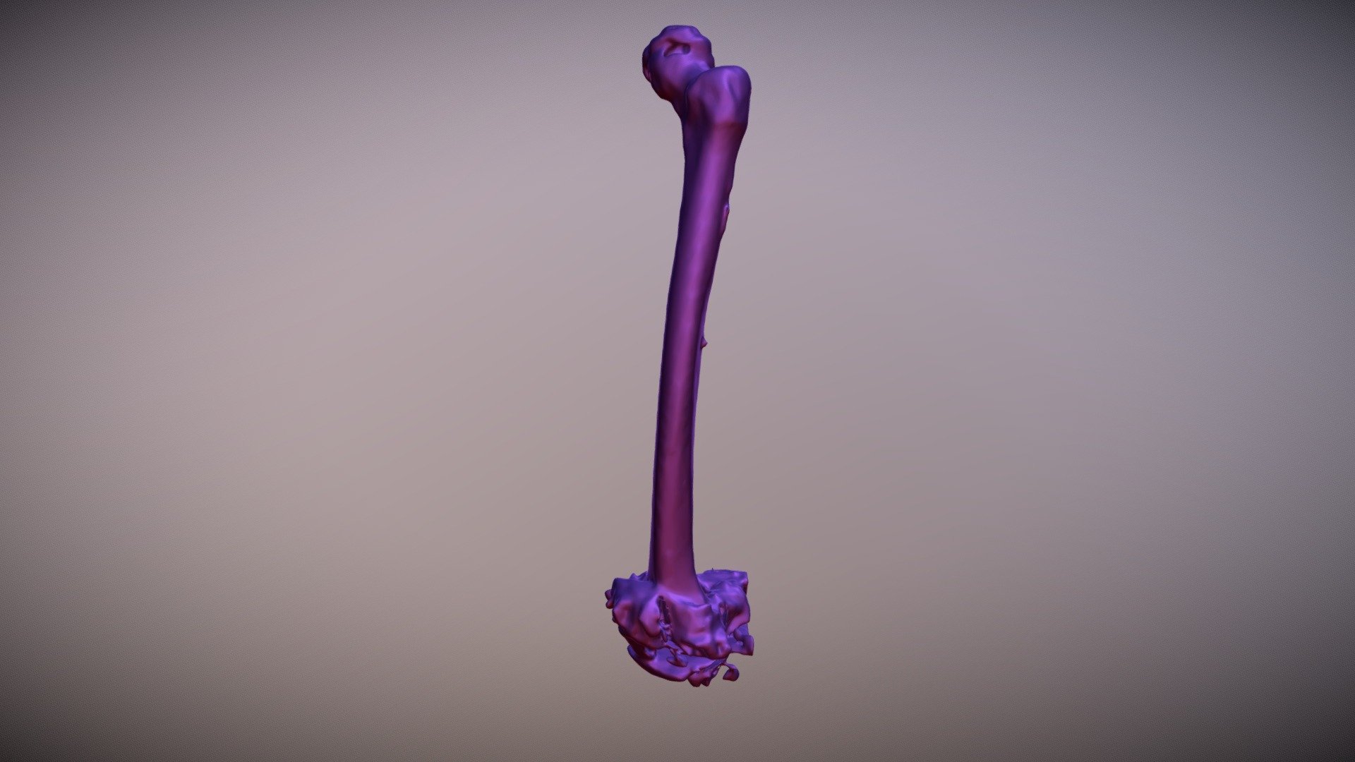 left femur