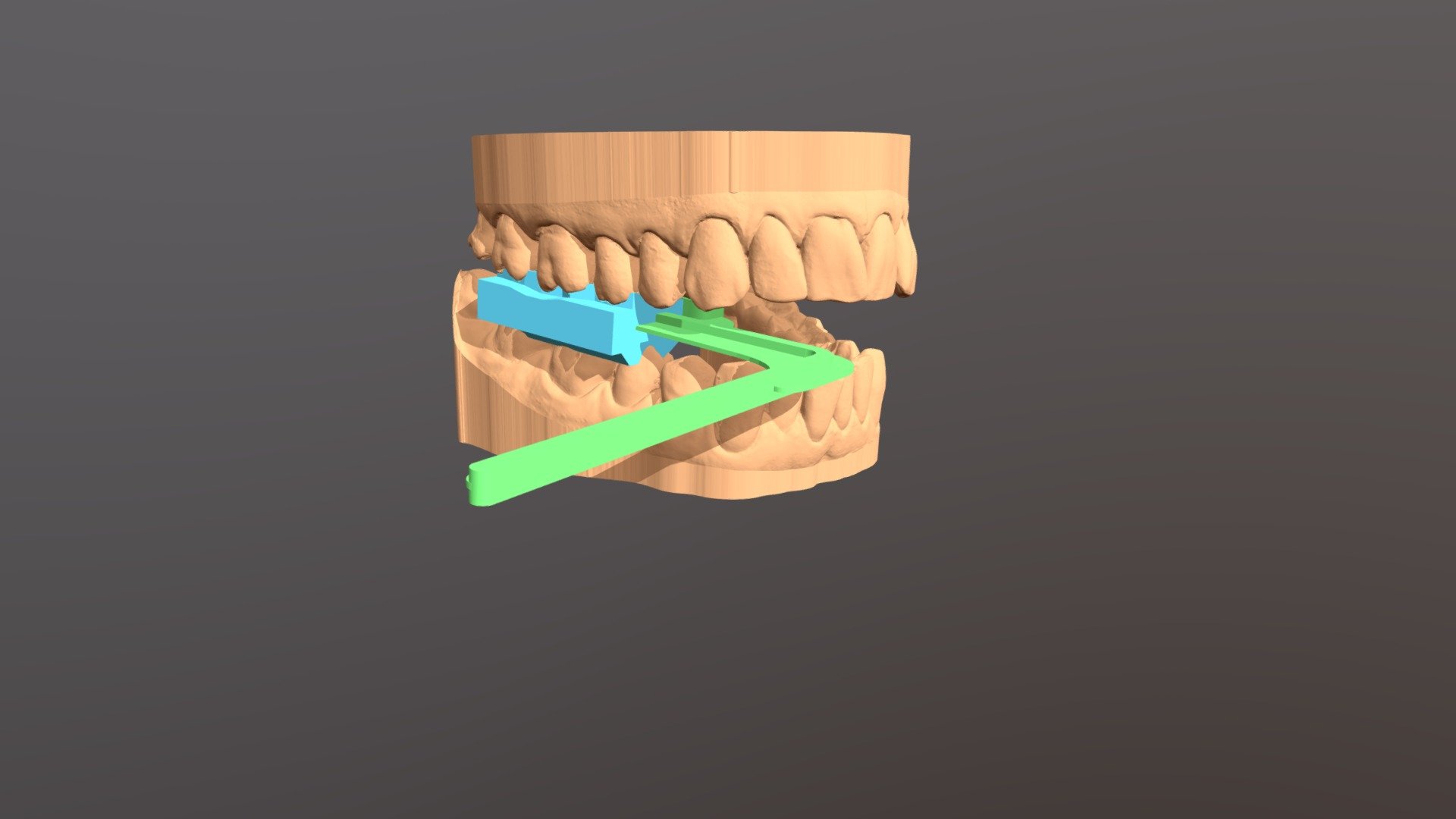 3D Xray Holder