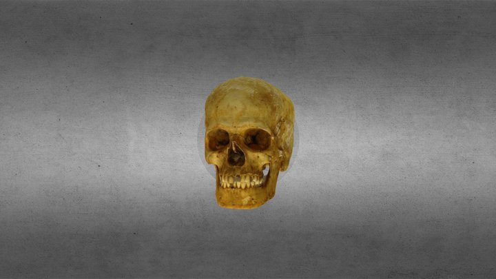 Cranio1 3D Model