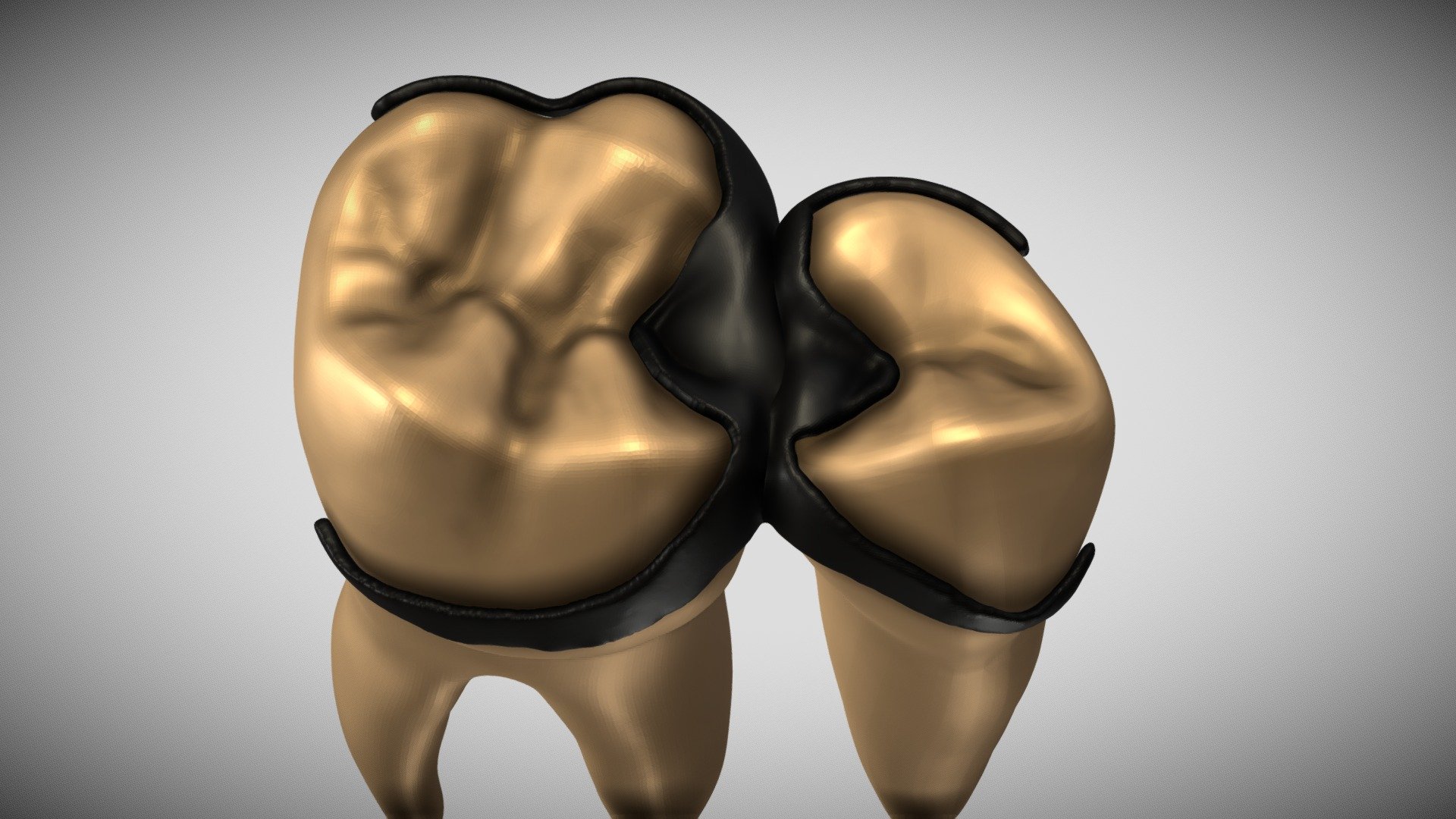Embrasure Clasp - 3D model by Muhammad Nabeel (@muhammadnabeelshaesha ...