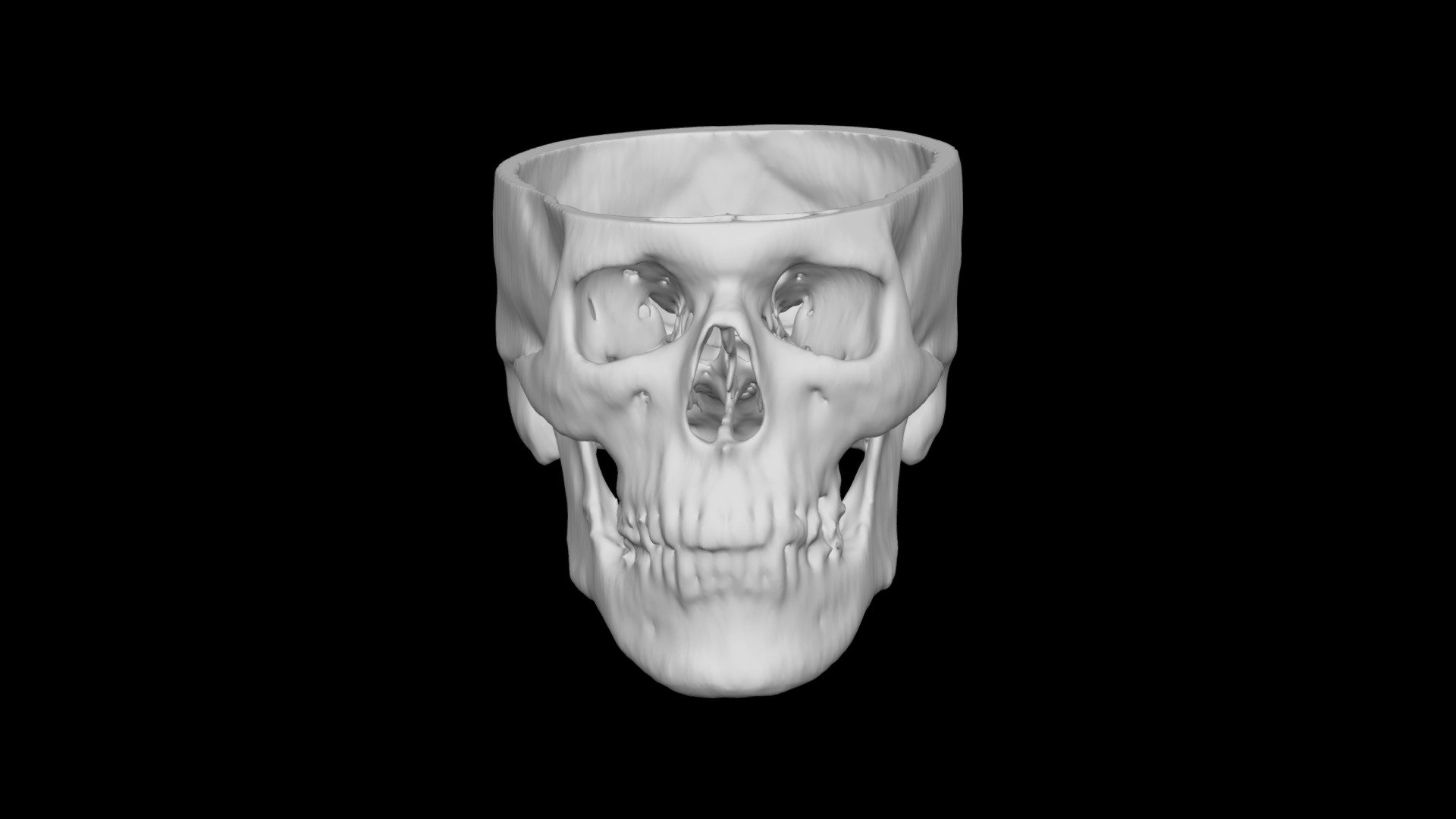 Skull Male 45yo