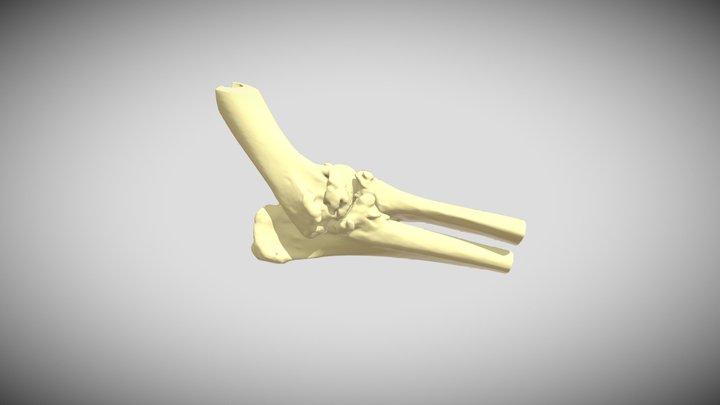 Displasia de codo EAI 3D Model