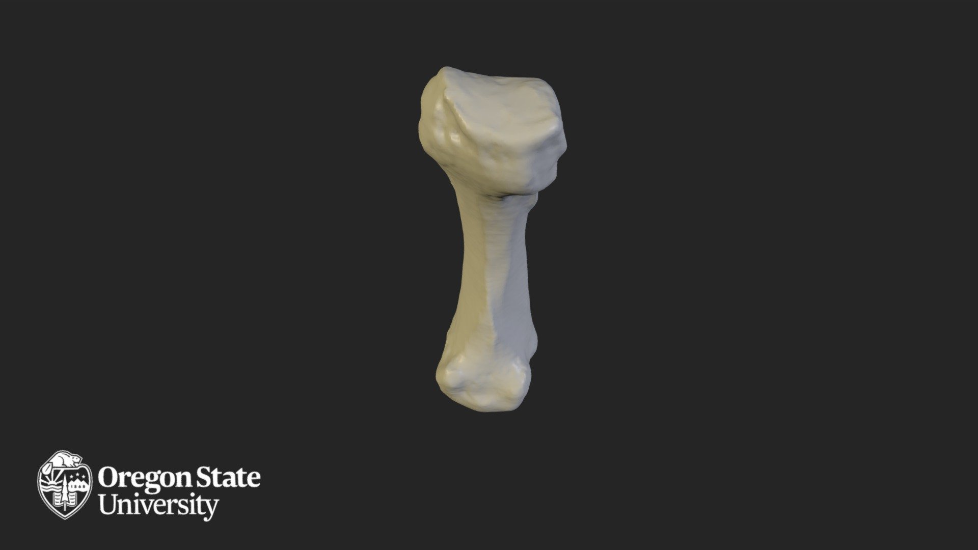 Metacarpal 5