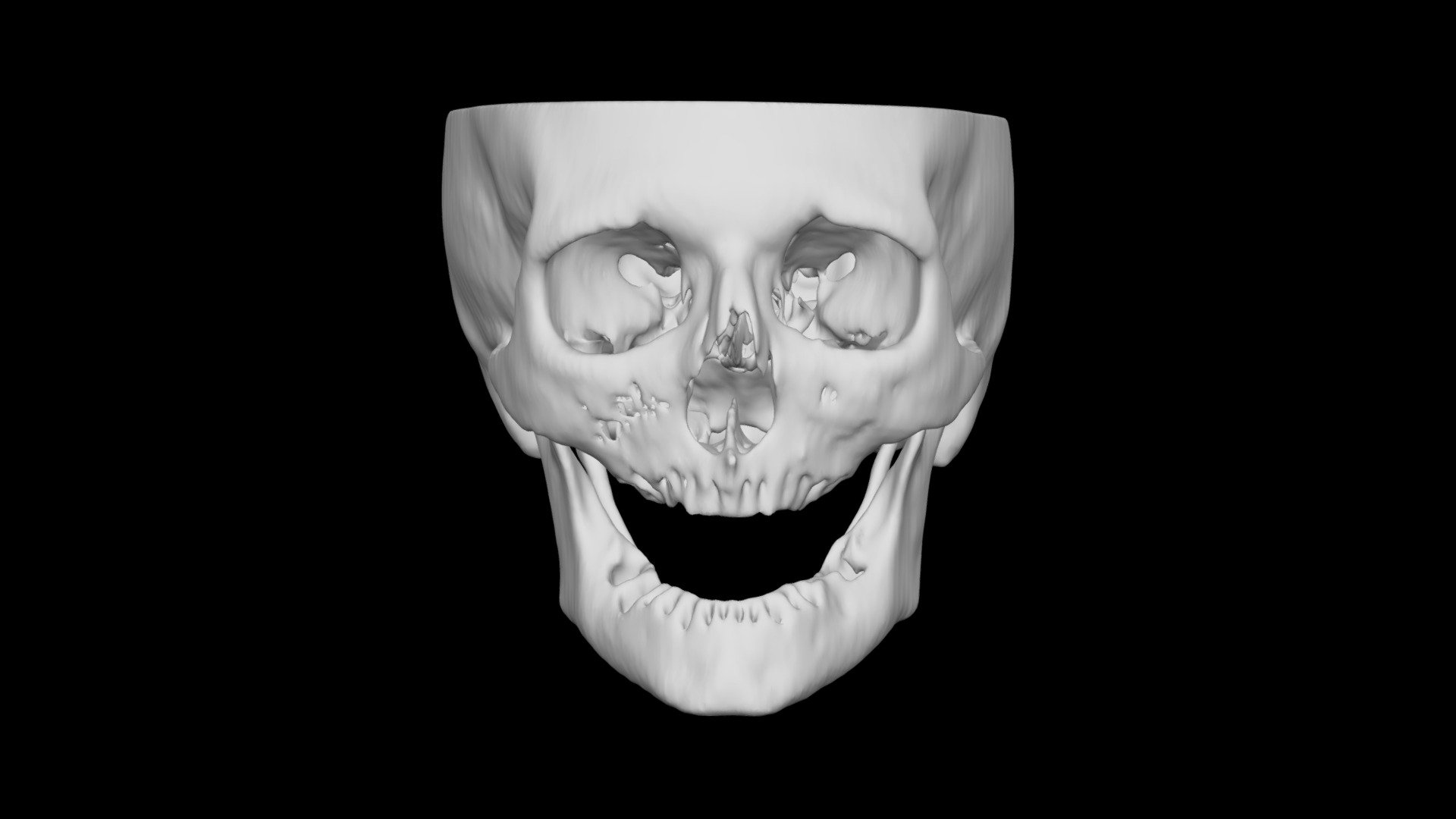 Skull Female 55yo