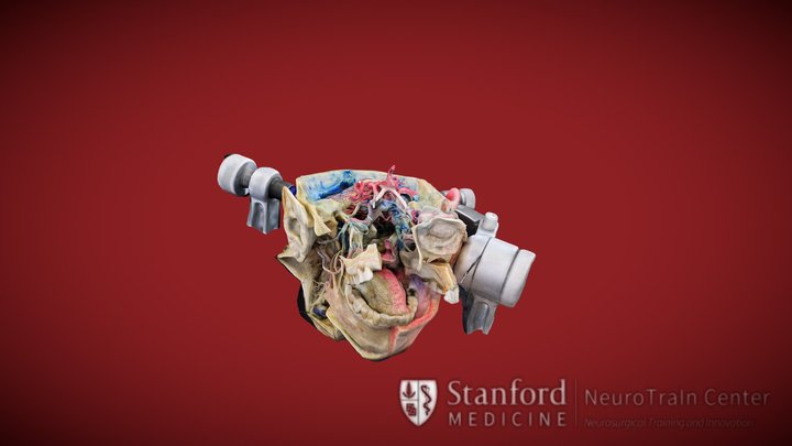 Central Skull Base 3D Model