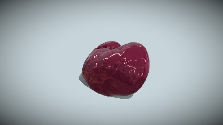 RIGHT KIDNEY 3D Model