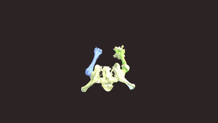 Pelvis and Femurs 3D Model