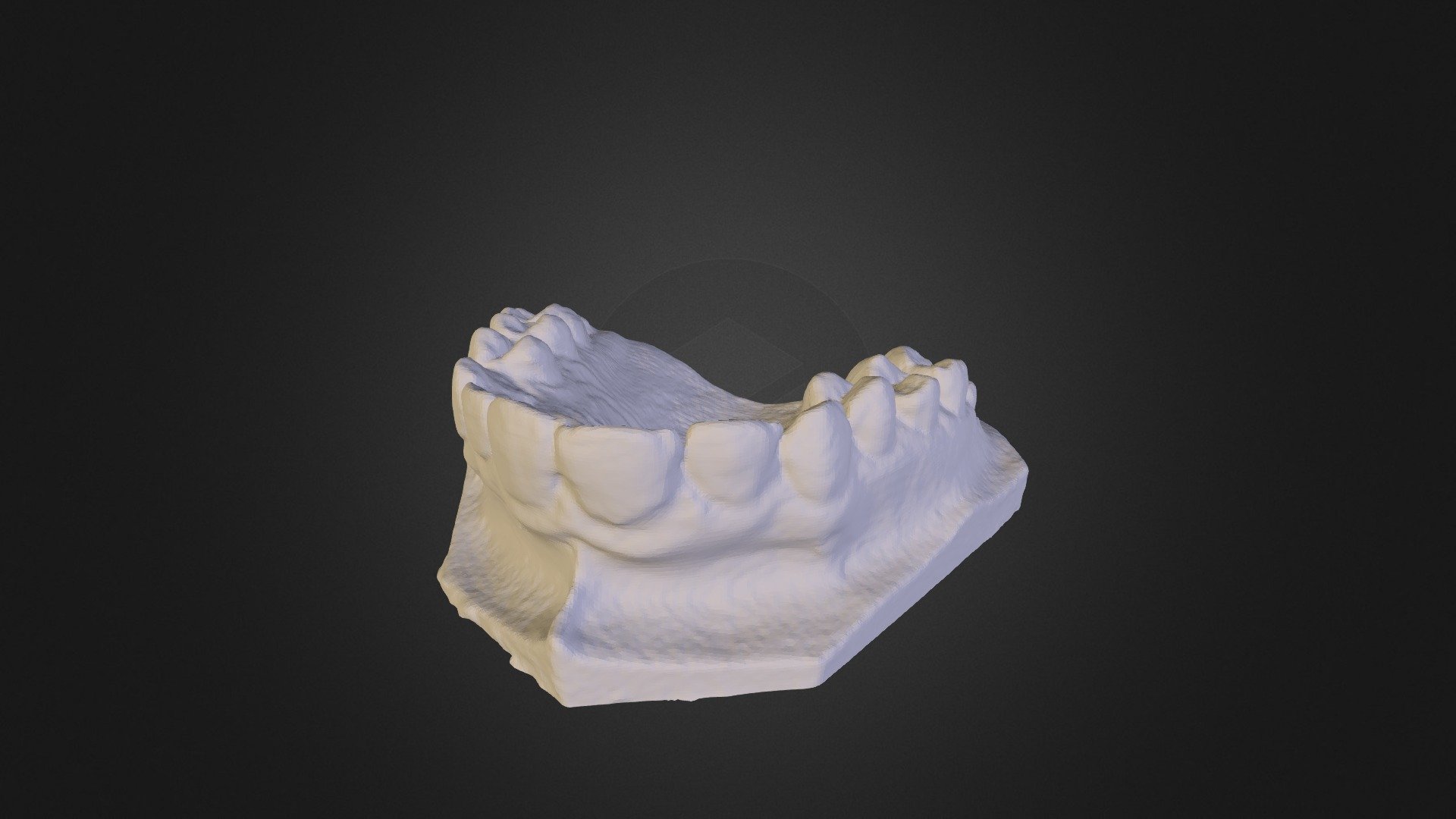 Teeth scan with Robocular Mini