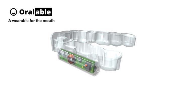 TGM attached to retainer 3D Model