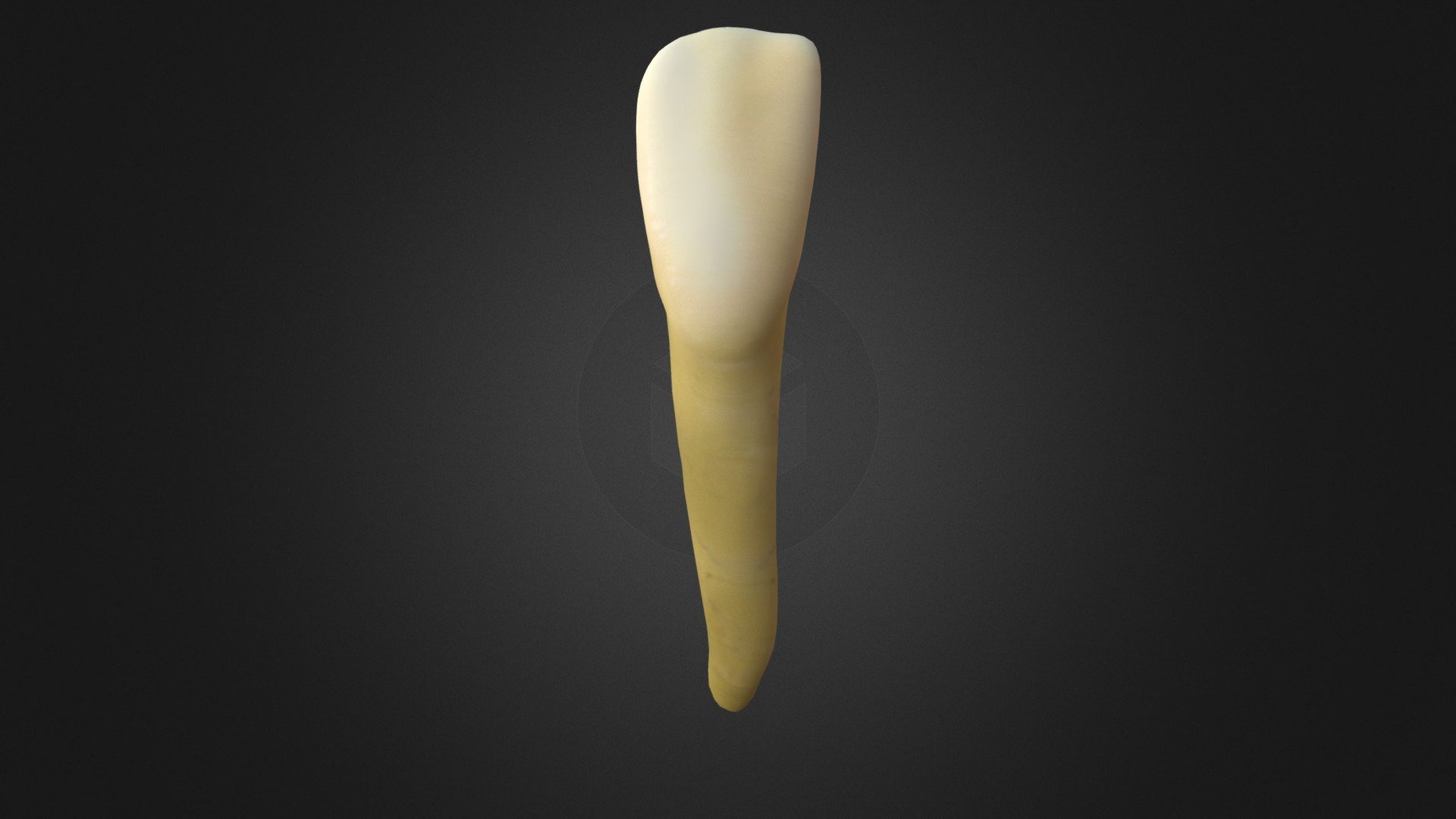 Lower Lateral Incisor