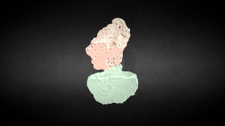 Ultrasound: Bladder and Rectum 3D Model