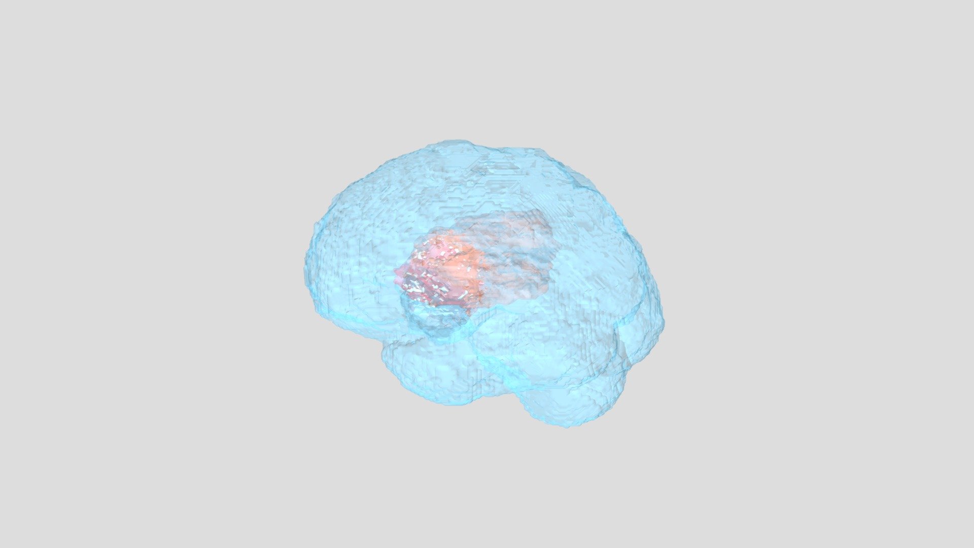 Brain & Brain tumor 3D model