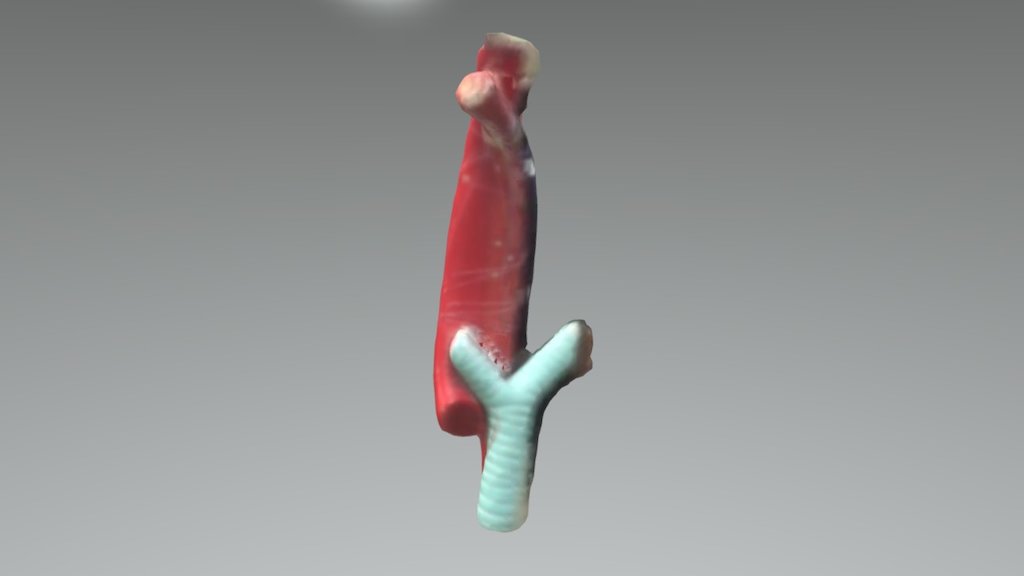Artery and Trachea